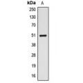 LifeSab™ ALDH3A1 Rabbit pAb (50 µl)