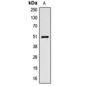LifeSab™ ALDH3A1 Rabbit pAb (50 µl)