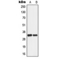 LifeSab™ ANT2 Rabbit pAb (50 µl)