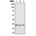 LifeSab™ ARF6 Rabbit pAb (50 µl)