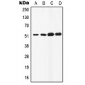 LifeSab™ ATP6AP1 Rabbit pAb (50 µl)