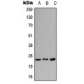 LifeSab™ CACNG1 Rabbit pAb (50 µl)