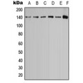 LifeSab™ Calcium Sensing Receptor (pT888) Rabbit pAb (50 µl)