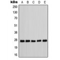 LifeSab™ p27 Kip1 (pT198) Rabbit pAb (50 µl)