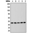 LifeSab™ C/EBP alpha (pT226) Rabbit pAb (50 µl)