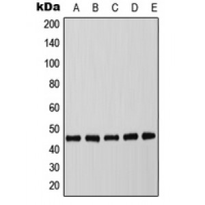 LifeSab™ C/EBP alpha (pT226) Rabbit pAb (50 µl)
