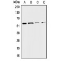 LifeSab™ CHRNA3 Rabbit pAb (50 µl)