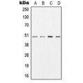 LifeSab™ AP2M1 Rabbit pAb (50 µl)