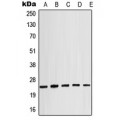 LifeSab™ Alpha-crystallin B (pS19) Rabbit pAb (50 µl)