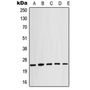 LifeSab™ Alpha-crystallin B (pS19) Rabbit pAb (50 µl)