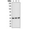 LifeSab™ CSK (pS364) Rabbit pAb (50 µl)
