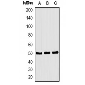 LifeSab™ CSK (pS364) Rabbit pAb (50 µl)