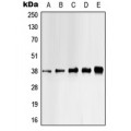 LifeSab™ CK1 alpha (pY321) Rabbit pAb (50 µl)