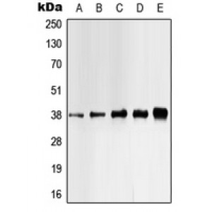 LifeSab™ CK1 alpha (pY321) Rabbit pAb (50 µl)