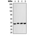 LifeSab™ CK1 delta Rabbit pAb (50 µl)