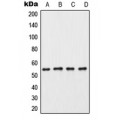 LifeSab™ CK1 gamma 3 Rabbit pAb (50 µl)
