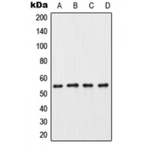 LifeSab™ CK1 gamma 3 Rabbit pAb (50 µl)