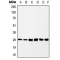 LifeSab™ CK2 beta (pS209) Rabbit pAb (50 µl)
