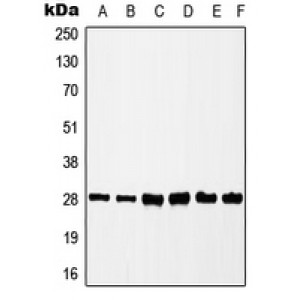LifeSab™ CK2 beta (pS209) Rabbit pAb (50 µl)