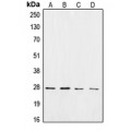 LifeSab™ CK2 beta Rabbit pAb (50 µl)