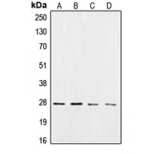 LifeSab™ CK2 beta Rabbit pAb (50 µl)