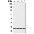 LifeSab™ EIF5A Rabbit pAb (50 µl)