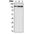LifeSab™ EPHA3 Rabbit pAb (50 µl)