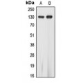 LifeSab™ EPHA5 Rabbit pAb (50 µl)