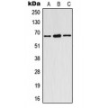 LifeSab™ ESR1 (pY537) Rabbit pAb (50 µl)