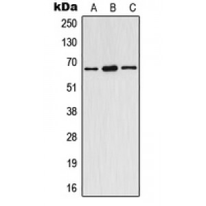 LifeSab™ ESR1 (pY537) Rabbit pAb (50 µl)