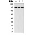 LifeSab™ FGFR1 (pY654) Rabbit pAb (50 µl)