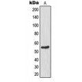 LifeSab™ Glucokinase Rabbit pAb (50 µl)