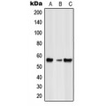 LifeSab™ GLRB Rabbit pAb (50 µl)