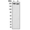 LifeSab™ GRLF1 (pY1087) Rabbit pAb (50 µl)