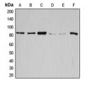 LifeSab™ GYS1 Rabbit pAb (50 µl)