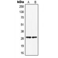 LifeSab™ HOXB5 Rabbit pAb (50 µl)