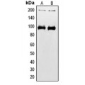 LifeSab™ IGF1 Receptor (pY1165/Y1166) Rabbit pAb (50 µl)