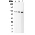 LifeSab™ IGF1 Receptor Rabbit pAb (50 µl)
