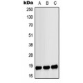 LifeSab™ MYL9 (pS20) Rabbit pAb (50 µl)