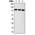 LifeSab™ ITIH2 Rabbit pAb (50 µl)