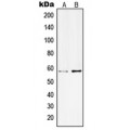 LifeSab™ Kv3.1 Rabbit pAb (50 µl)