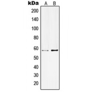 LifeSab™ Kv3.1 Rabbit pAb (50 µl)