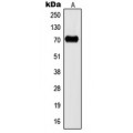 LifeSab™ Kv3.2 Rabbit pAb (50 µl)