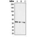 LifeSab™ MMP14 Rabbit pAb (50 µl)