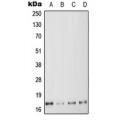 LifeSab™ MYL6 Rabbit pAb (50 µl)