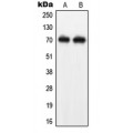 LifeSab™ NEFL Rabbit pAb (50 µl)