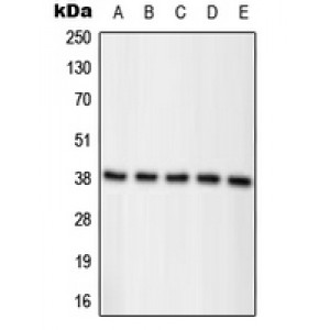 LifeSab™ Nucleophosmin (pT234) Rabbit pAb (50 µl)