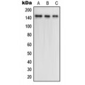 LifeSab™ TRK B (pY516) Rabbit pAb (50 µl)
