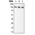 LifeSab™ Pyruvate Carboxylase Rabbit pAb (50 µl)