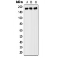 LifeSab™ PDGFR beta Rabbit pAb (50 µl)